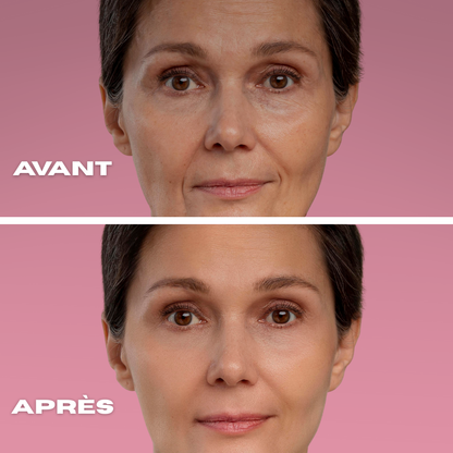 GORICHE – Steam Spa Oculaire