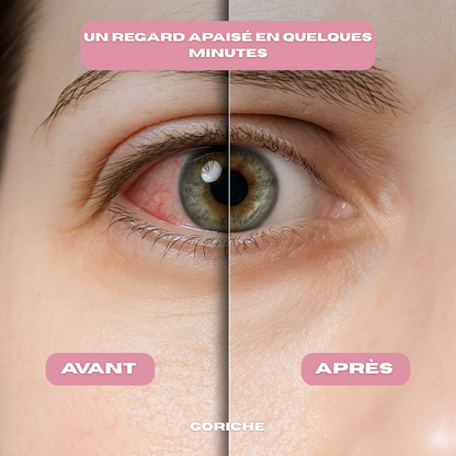 GORICHE – Steam Spa Oculaire